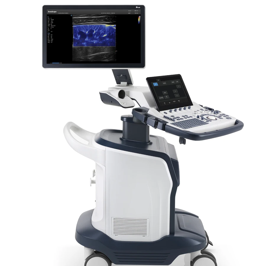 Intelligent Wis+ platform Color Doppler Sonoscape S60 Available