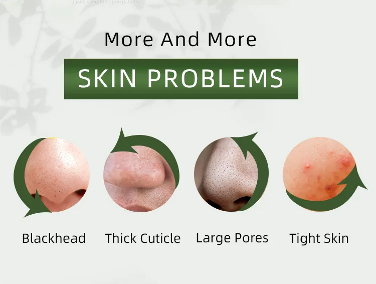 200gTea tree clean acne mud mask