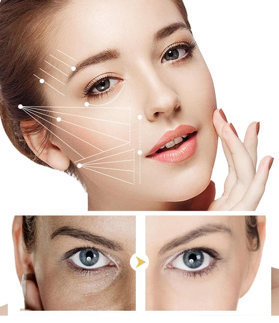 OEM Skin Care Turmeric Extract Lightening Oil Cream Soap Turmeric Skin Care Set for Whitening Brighten