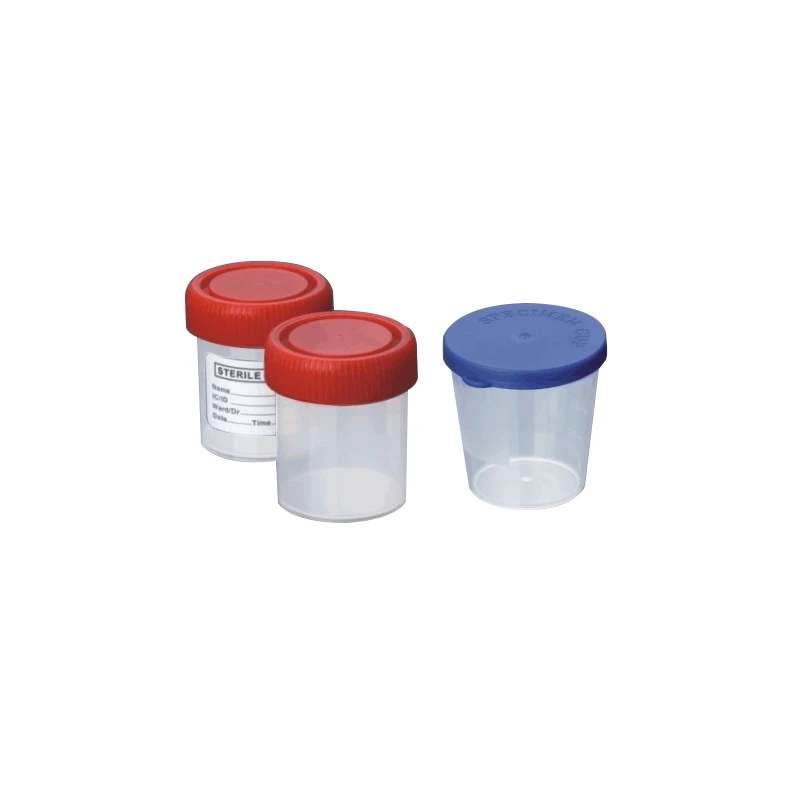 Laboratory Disposable PP Graduated  Specimen Container for Urine collector sampling test with Label (40ml, 60ml)