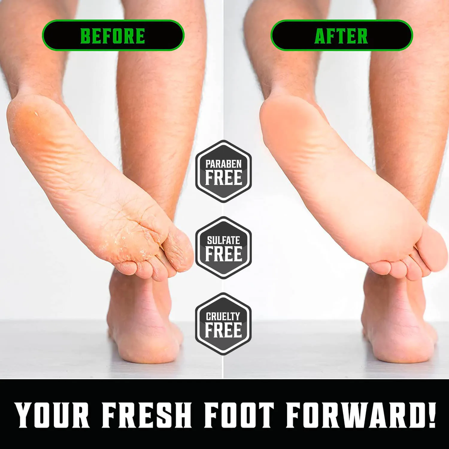 Tea Tree Foot Cream for Dry Cracked Heels Foot Balm Repair Cream with Aloe Vera and Mint