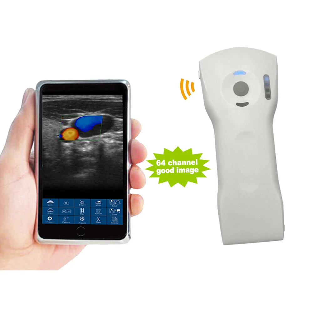 Wireless Medical Ultrasound Probe Portable And Convenient For Diagnostic Imaging