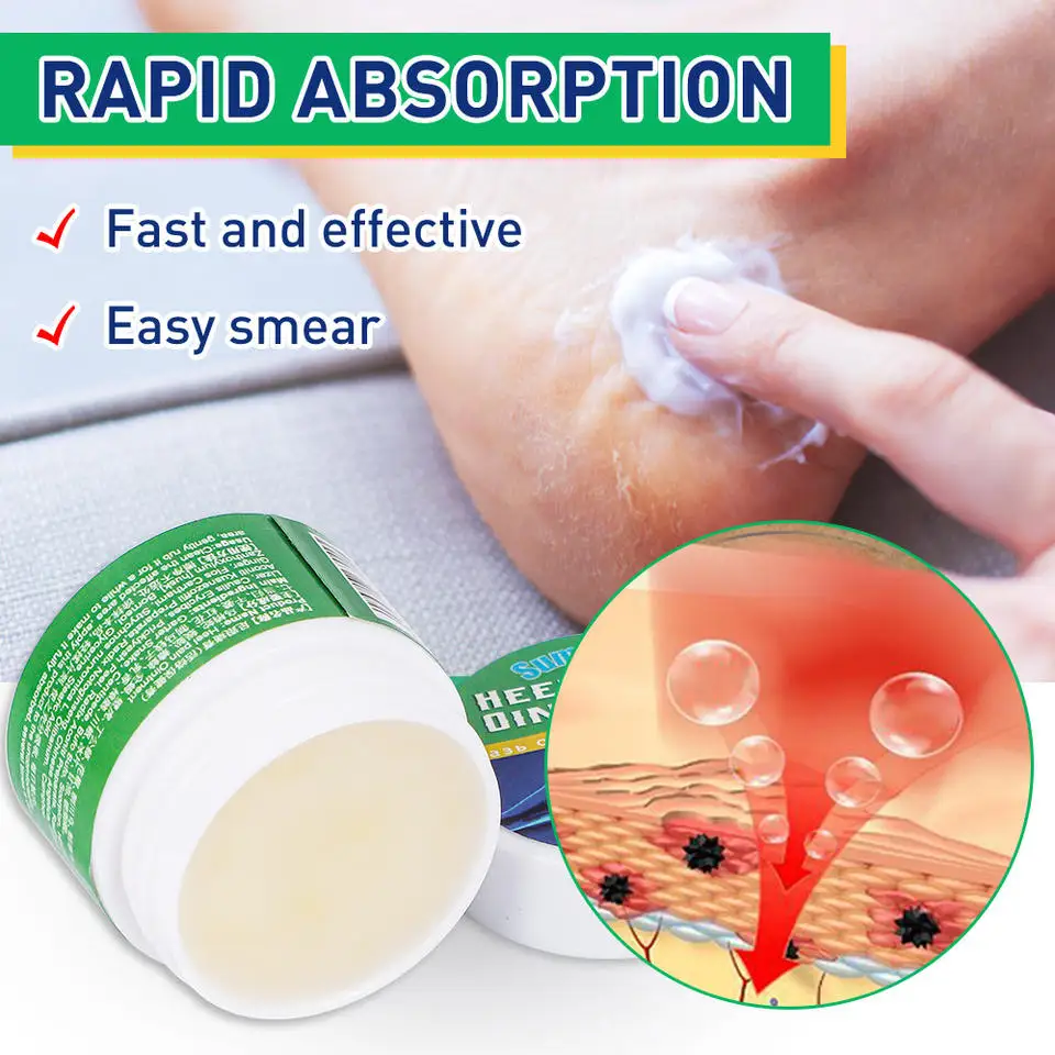 TikTok Hot Heel Spur Pain Relief Cream Herb Foot Analgesic Medical Ointment Treat Bone Achilles Tendonitis Arthritis Orthopedic