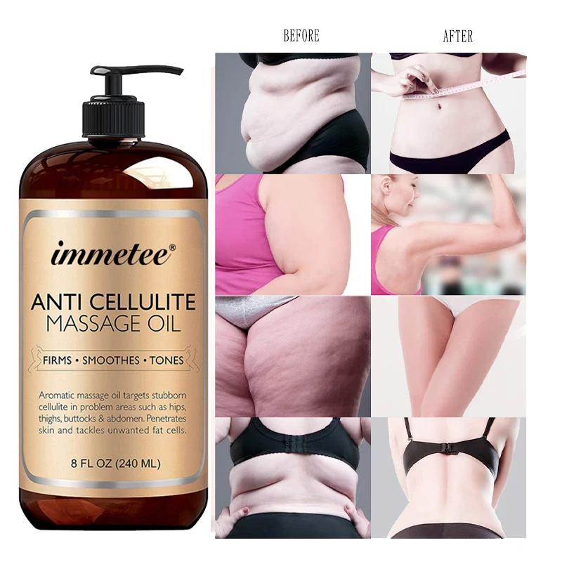 Immetee Private Label Herbal Slimming Oil Fat Burning Lipo Slimming Oil Firming Slimming Oil