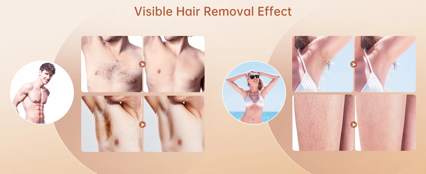 Women Shaver Hair Removal Customized logo Household Hair Removal Device Portable Laser Epilator Painless Permanent Hair Remover