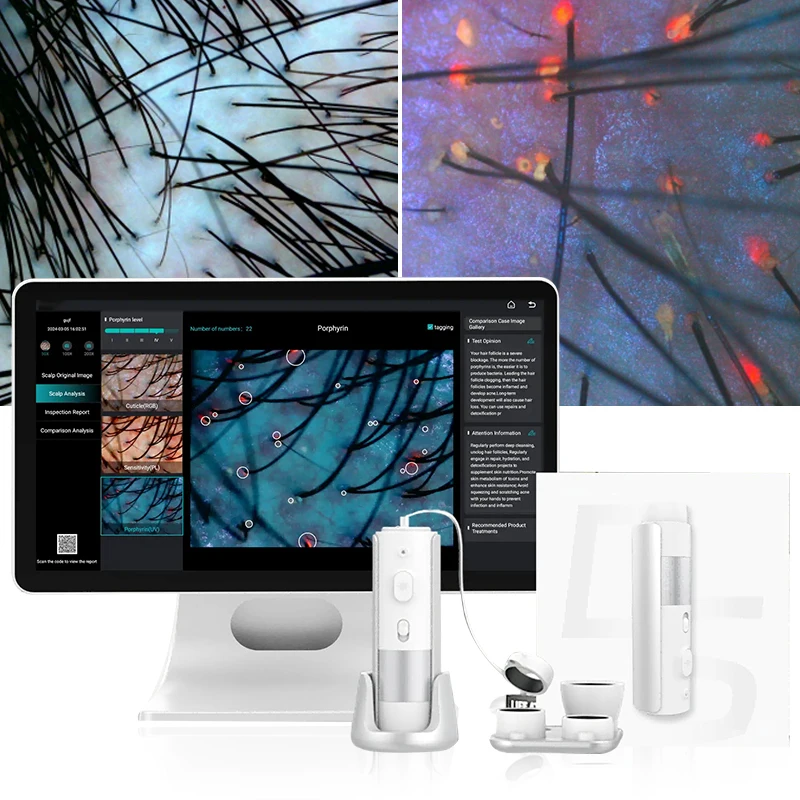 2024 Handheld Full Hd Ai Technology Hair Analysis Equipment 7 In 1 Scalp Hair Analyzer Machine Scalp Analysis Machine