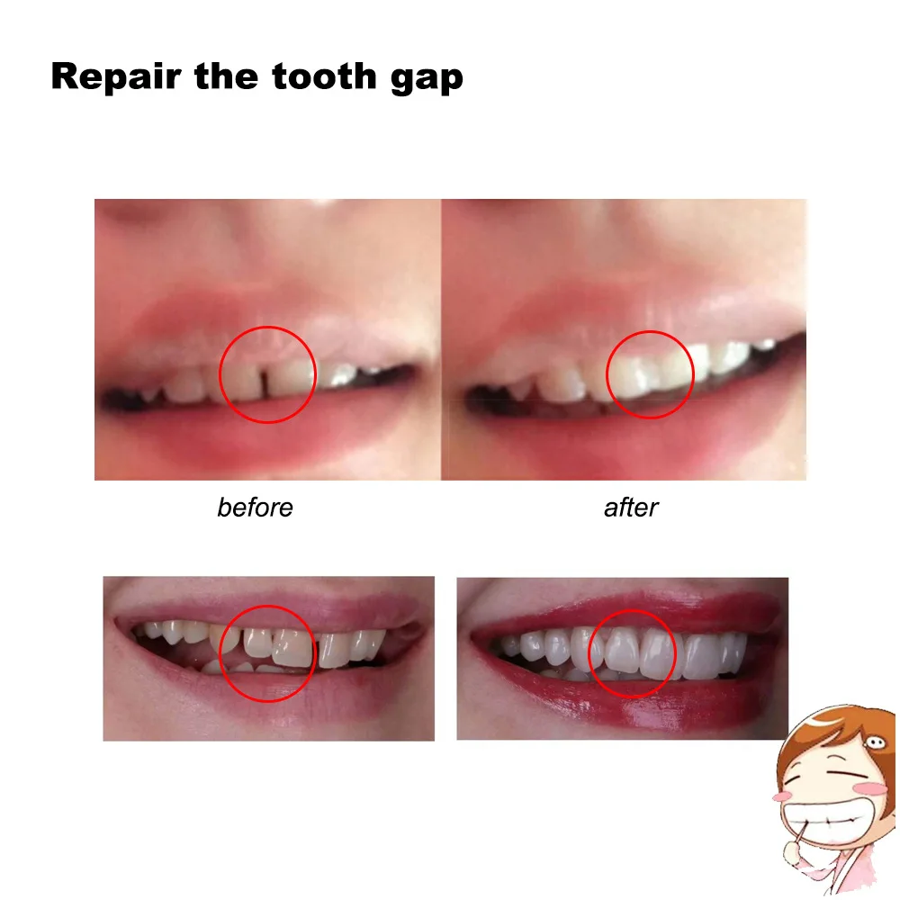 3Colors temporary Dental Oral False Fake Teeth Tooth Filling Repair Smile Snap on Veneers Dentures Case Paste Adhesive Beads