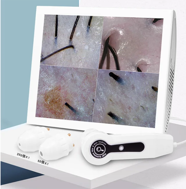 15 Inch HD Screen Portable Facial Skin Test Scanner Analyser Equipment Hair Skin Analyzer Machine For Sale