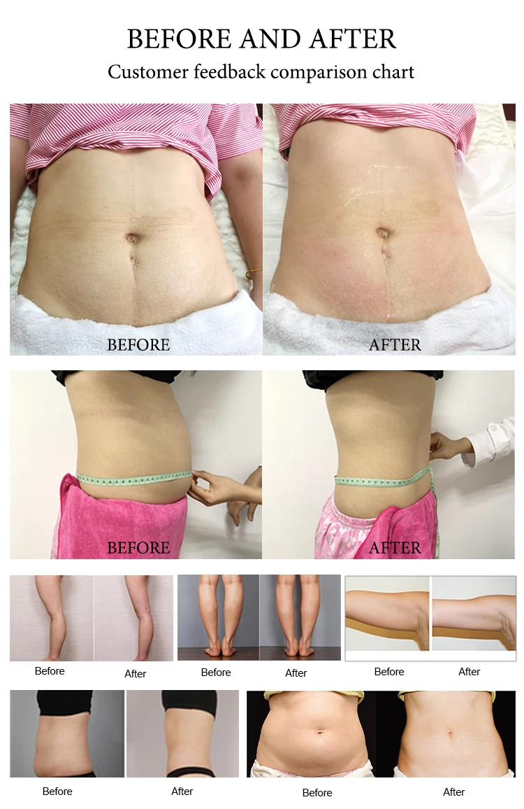 2024 New Rf Cavitation Reduce Cellulite Sculpt Body Machine 20K Ultrasonic Cavitation Machine Radio Frequency Cavitation Machine