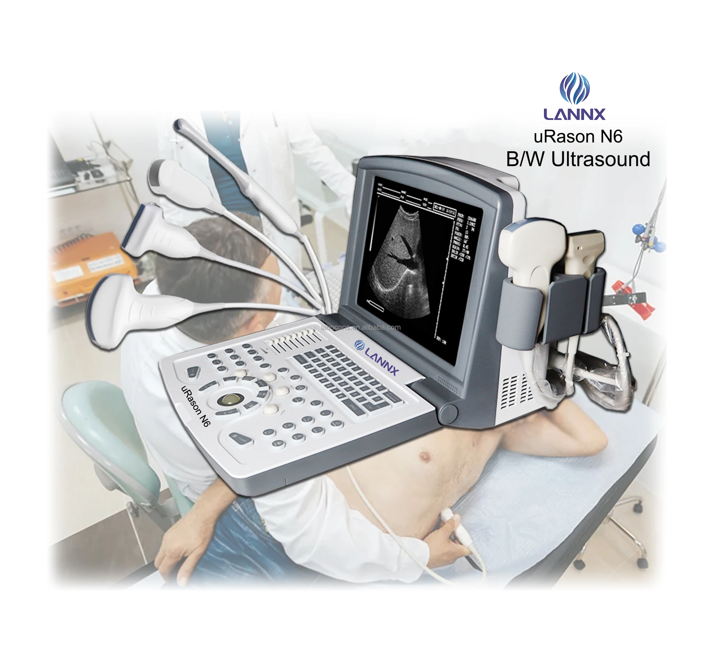 LANNX uRason N6 Hot sale Clinical Application Ultrasound Machine 128 permanents USG Portable device ultrasonic diagnostic