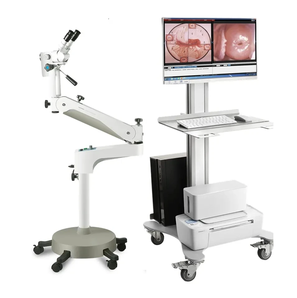 Kernel KN-2200B 2.1MP Video colposcope  HD gynecological colposcope Portable optical Video Colposcope