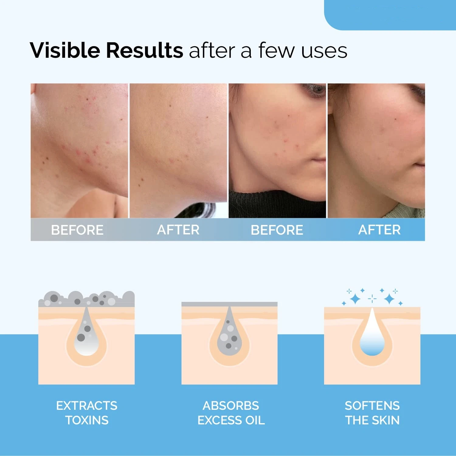 Deep Cleansing Skin Hyaluronic Acid Dead Sea Face Body Care Sheet Mud Mask For Women And Men