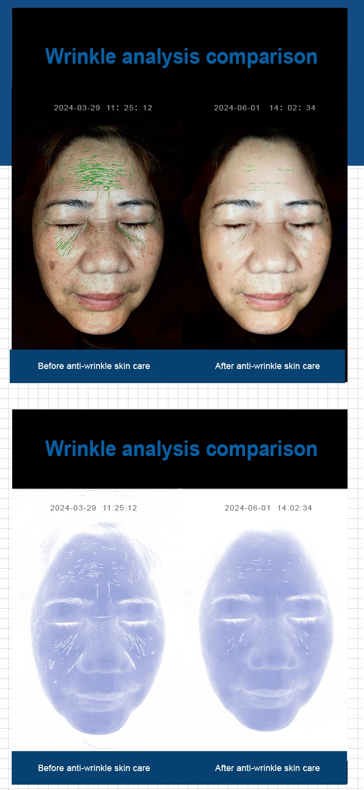 Professional Top Sale High-Definition AI Skin Facial Scanner Analyzer Machine 3D Face Skin Analysis Test Wifi Digital