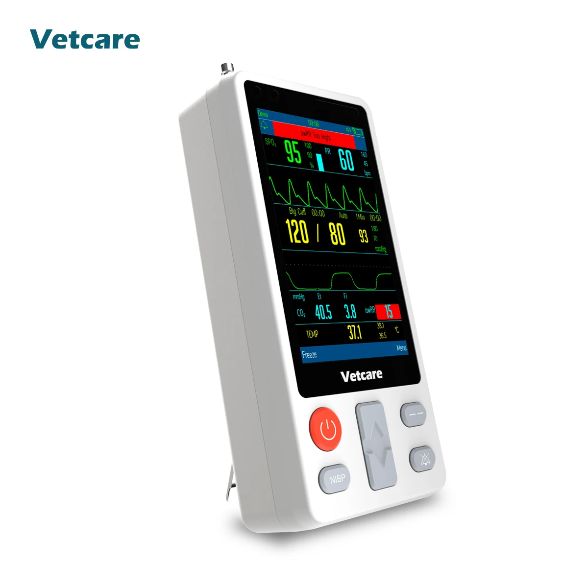 Special design of handheld monitor HMvet series:the anti-interference ability from motion and detection even at low perfusion