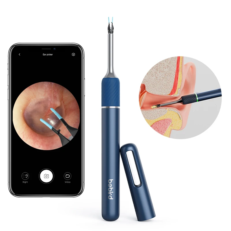Bebird Note5 Video Otoscope Ent Diagnostic Sets with LED light ear wax removal tool