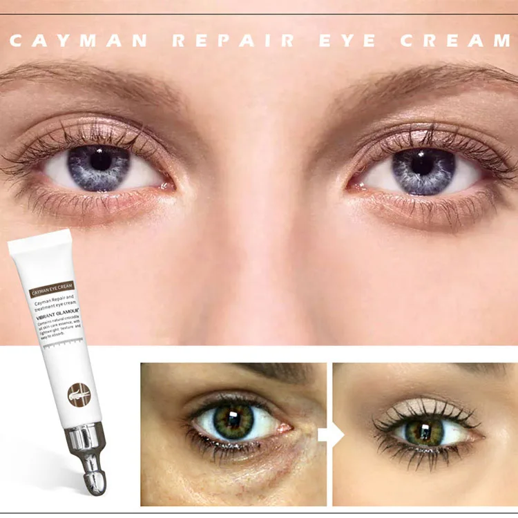 Eye Care Cream Remove dark circles and fine lines moisturizing Crocodile oil eye cream