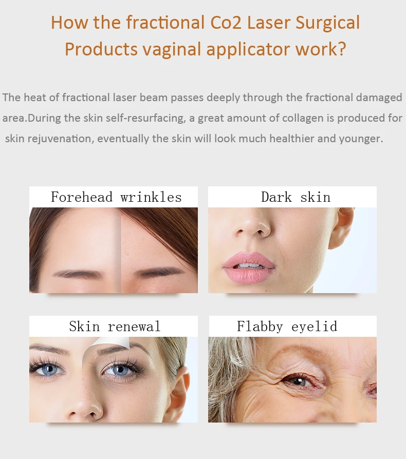 
Co2 Laser Portable Radio Frequency Face Lift Device Rf Beauty Instrument Equipment 