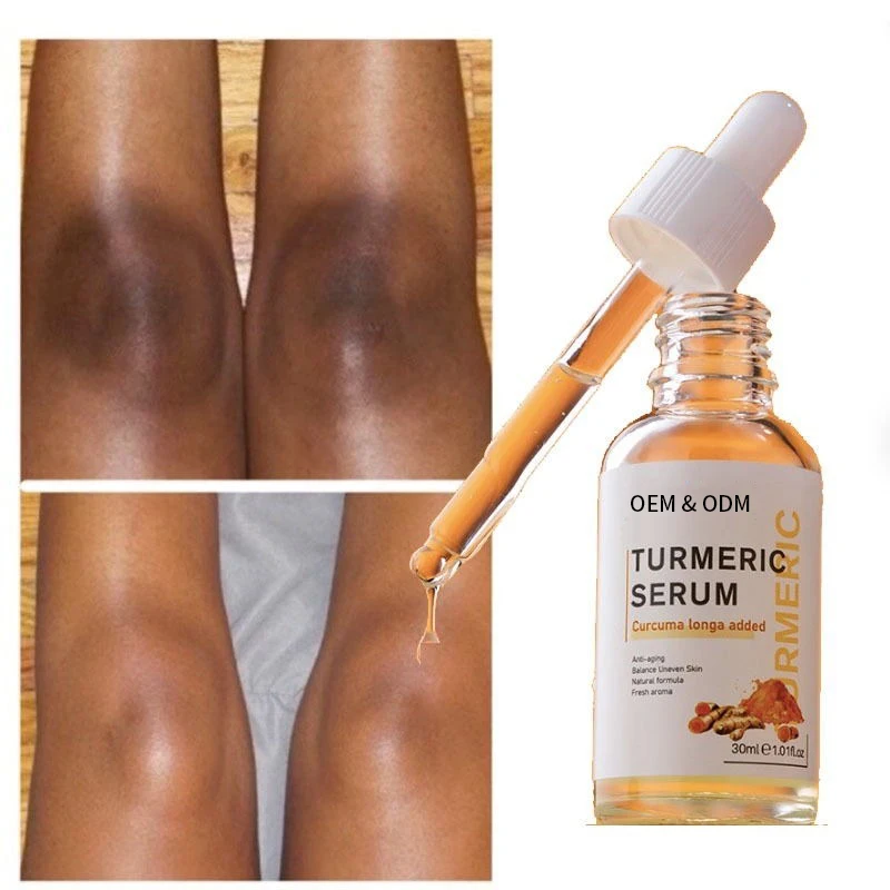 Facial Turmeric Skin Care Brightens Anti-Acne Dark Spots Removal Serum Turmeric Root Extract Turmeric Serum