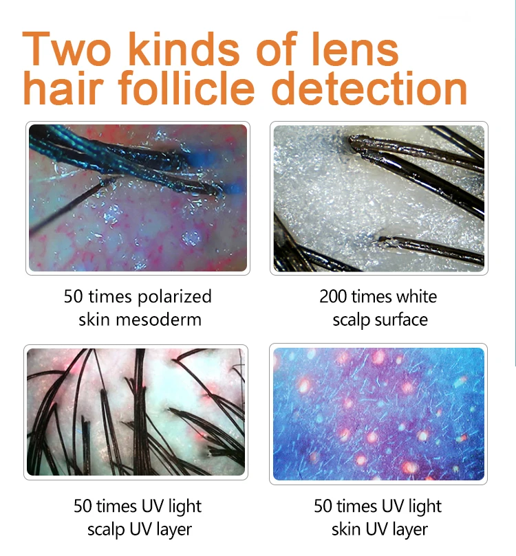 Home use 5 in 1 scalp hair analyzer beauty skin hair scalp detector analyzer professional beauty machine