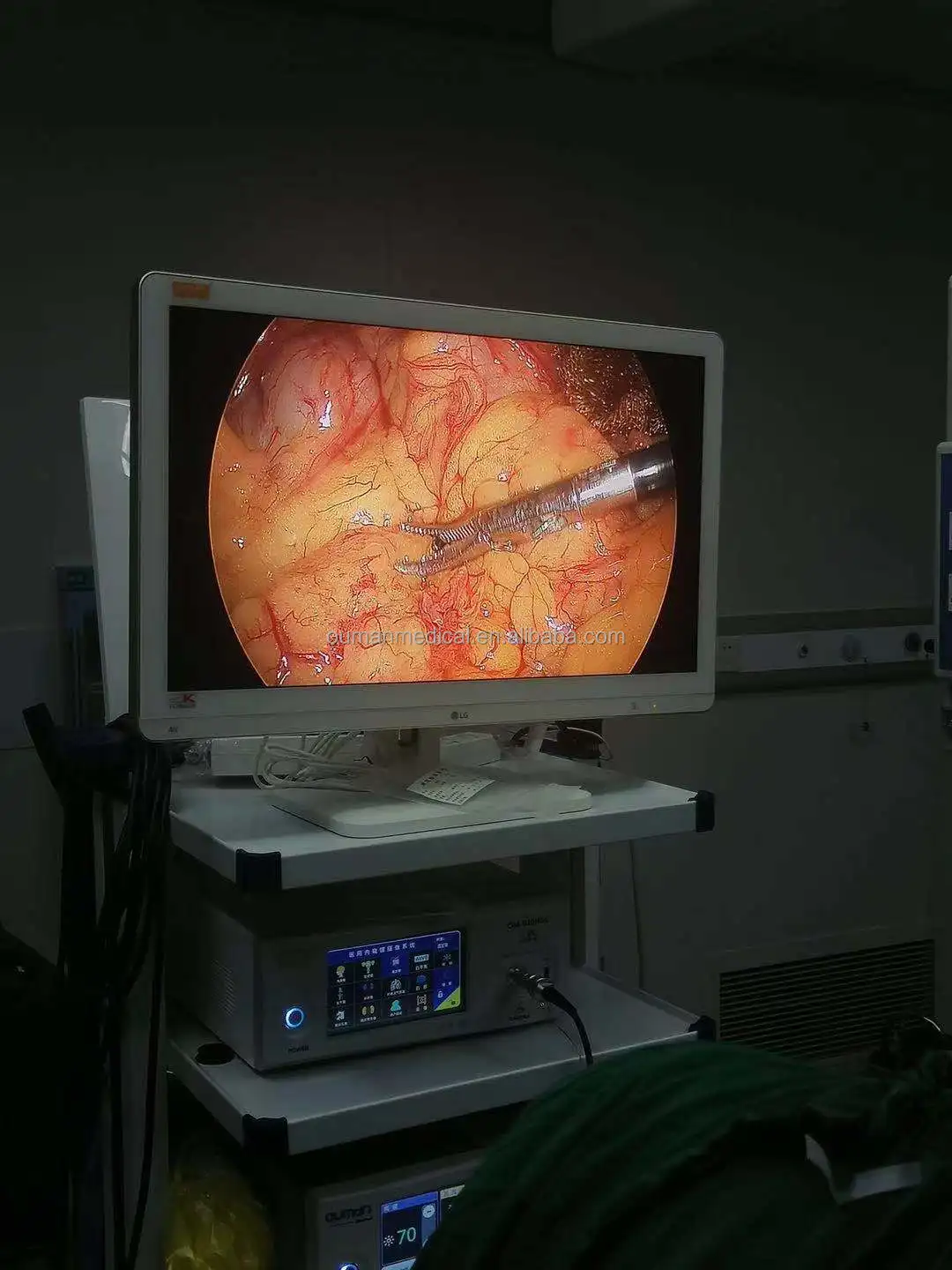 Medical Grade Monitor 27 inch Surgical monitor for Endoscopy ENT Hysteroscopy Laparoscopy