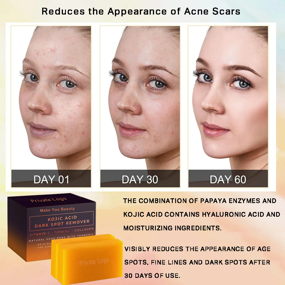 New Nature Organic Original Honey Kojic Acid Skin Whitening Soap Private Label Wholesale Lemon Turmeric and Kojic Acid Soap