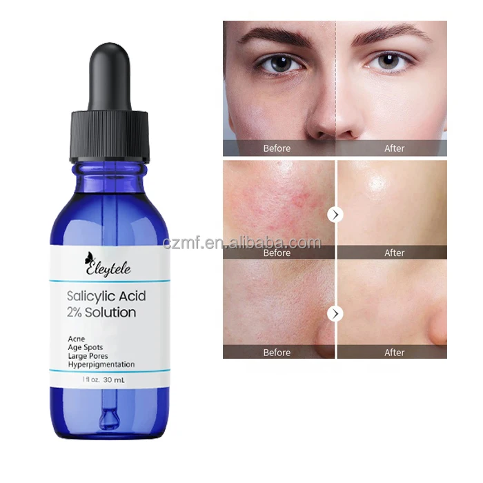 Фирменная азелаиновая кислота для очистки кожи оригинальный раствор обычная салициловая 2% сыворотка отшелушивающая Органическая Сыворотка ухода за кожей