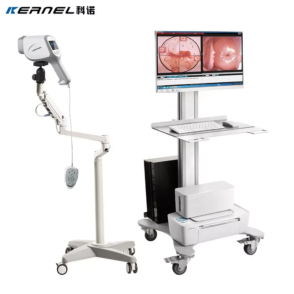 KN-2200I First Fully Mobile High- Definition Colposcope Digital Colposcopy Dynamic Spectral Imaging for Detection of Cervical