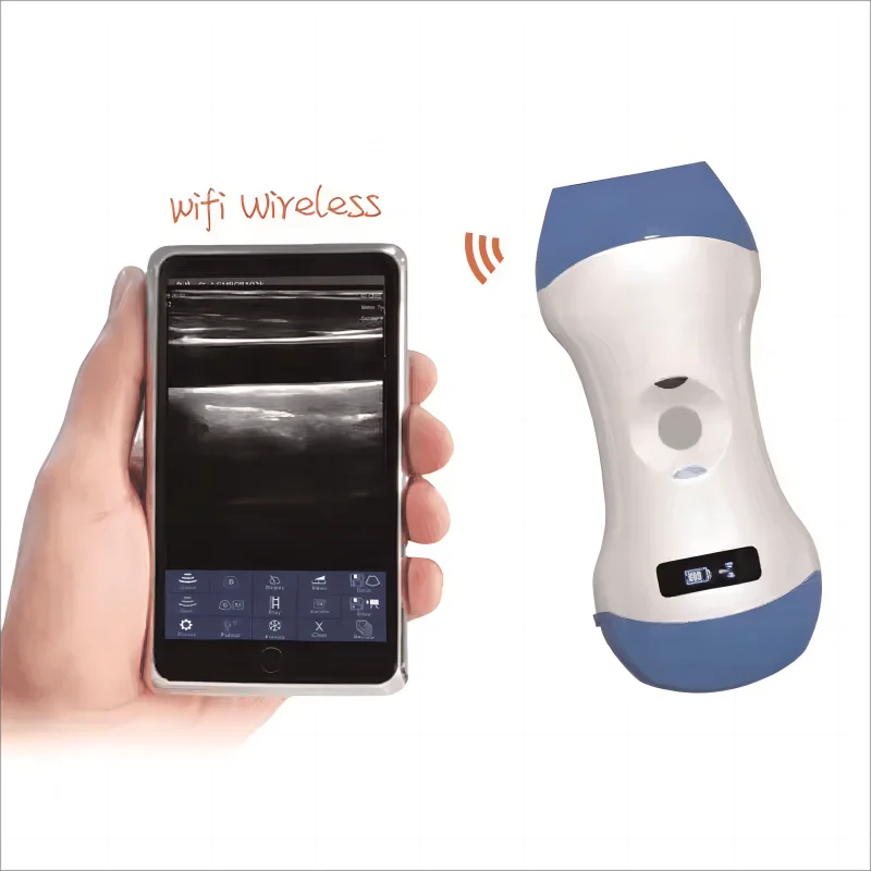 3 in 1 Wireless Color Doppler Ultrasound Machine Double Heads