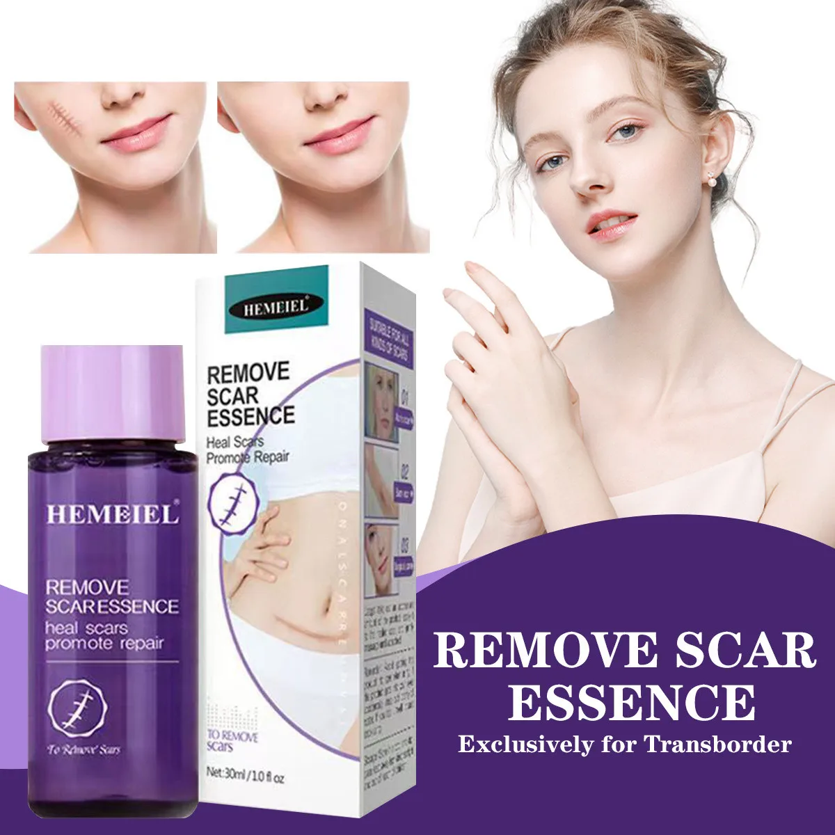 wholesale herbal anti stretch marks and scar remover oil essence