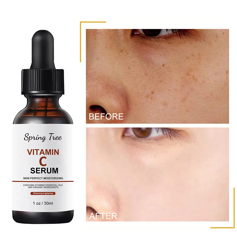 vitamin C skin care anti-aging skin care products anti acne black spots anti-aging Repair Serum