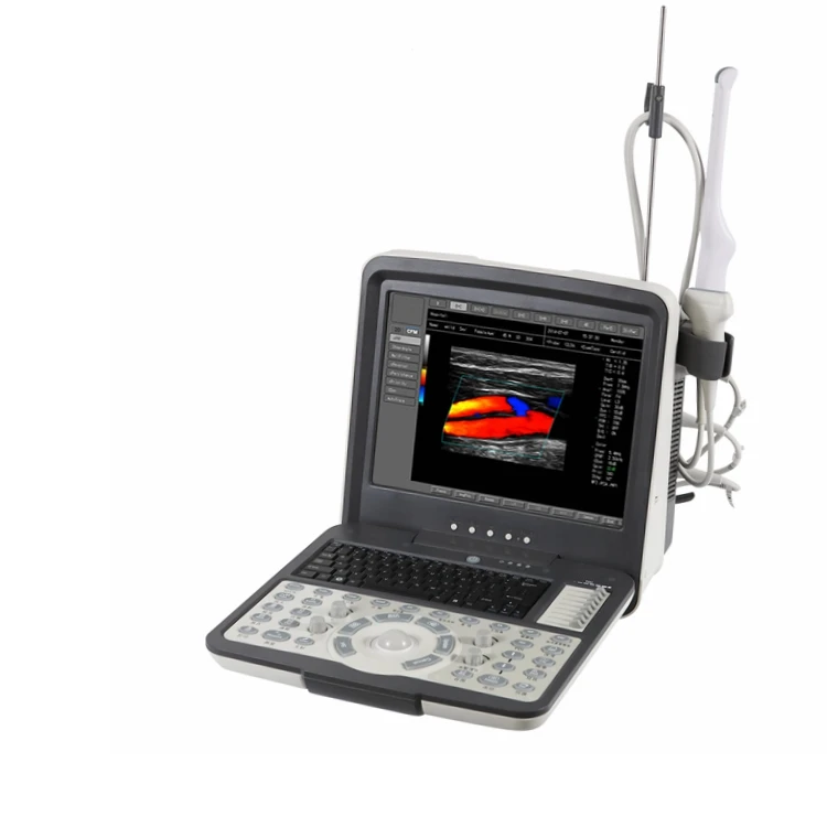 Недорогой портативный цветной допплеровский ультразвуковой аппарат Ecograph Laptop