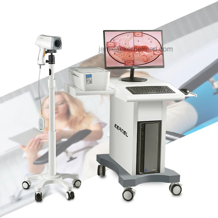 High resolution colposcope video camera colposcopy exam system digital colposcope