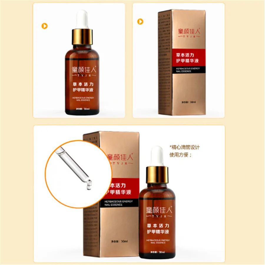 Fungal Nail Treatment Feet Care Essence Nail Foot Whitening Toe Nail Fungus Removal Gel Anti Infection Paronychia Onychomycosis