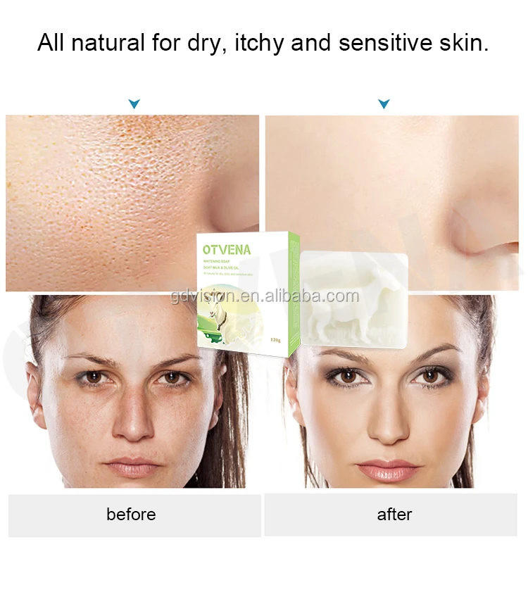 Private Label Skin Lightening Acne Removing Natural Handmade Goat Milk Soap