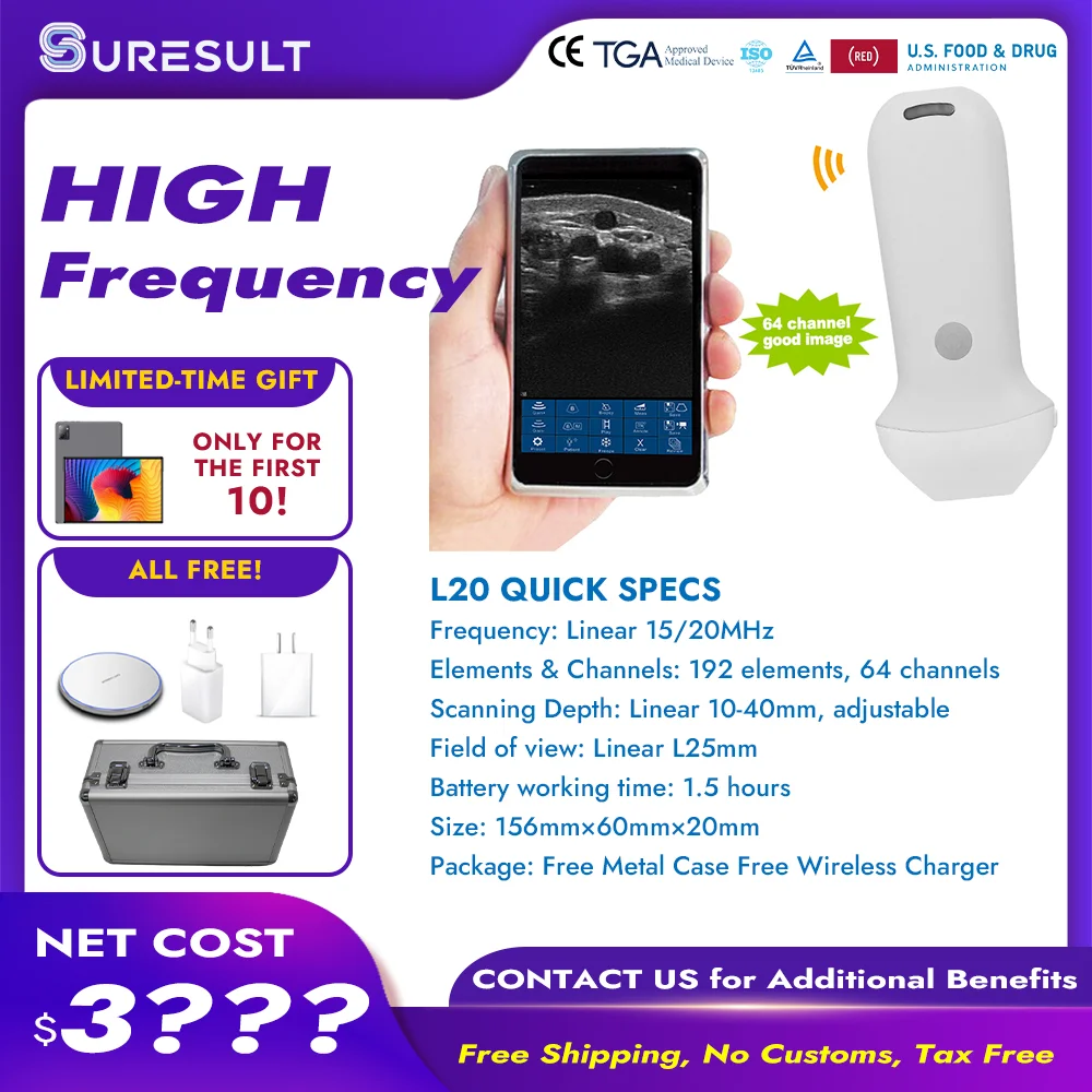 Handheld Portable Ultrasound Equipment for Veterinary Use Equine and Pig Ultrasound for Pregnancy Diagnosis