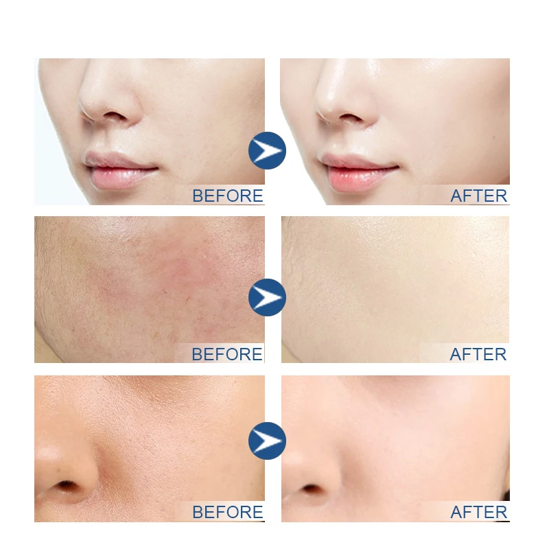 Private Label Anti Wrinkle Facial Skin Care Whitening Natural 24k Gold Caviar Serum Organic Collagen Face Essence