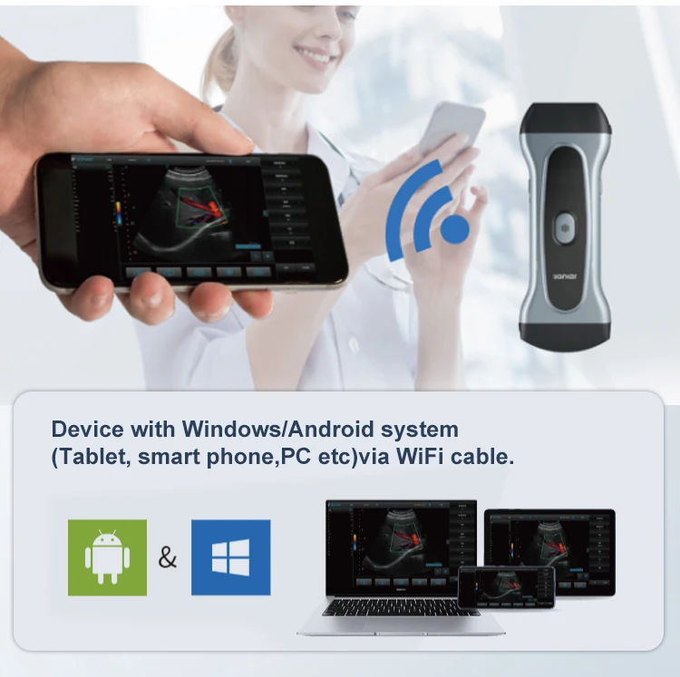 Yonker pocket veterinary ultrasound scanner portable Handheld WiFi Color wireless ultrasound probe vet for animal cat pet dog