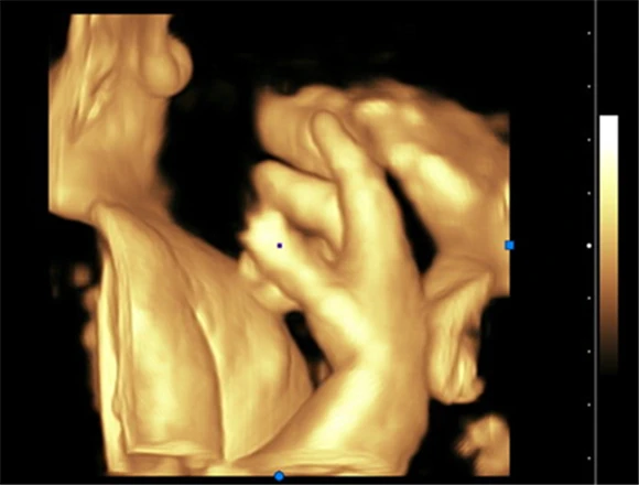 DW-P5pro  Portable Medical Machine Ultrasound Scanner High-end 4D Color Doppler Ultrasound Machine