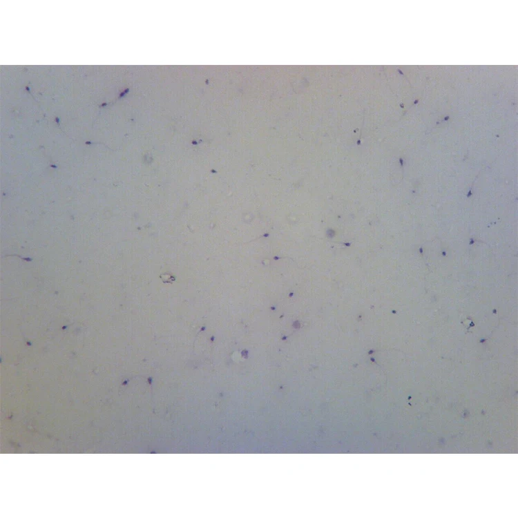 School and Medical Hot Sale Human Chromosome microscope prepared slides