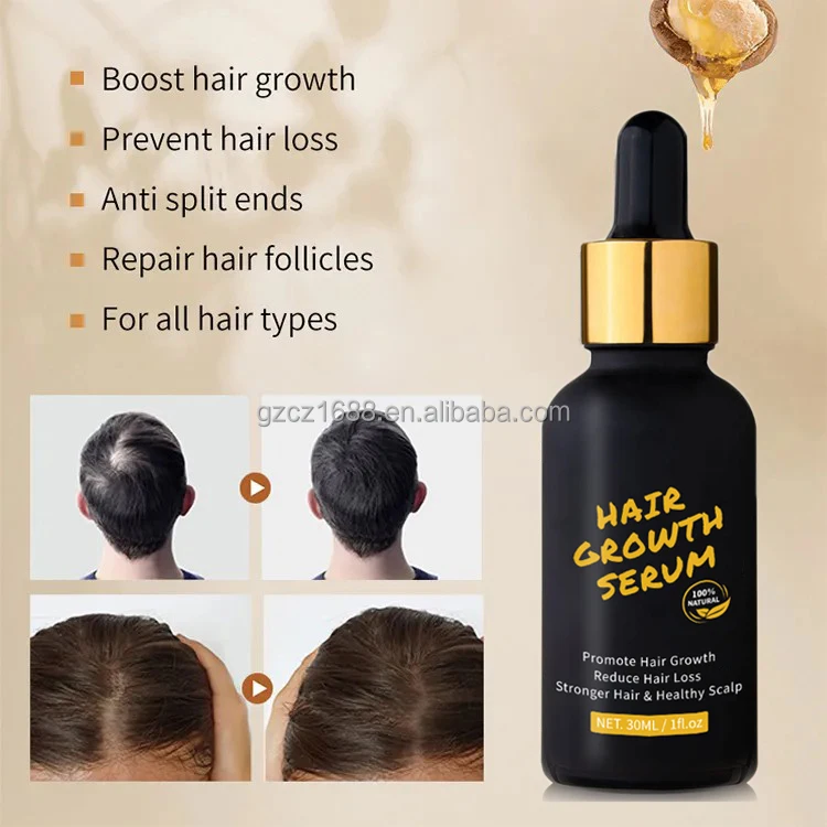 Customize Logo Biotin Human Hair Growth Serum Treatment Prevents Hair Loss Thinning Natural Ingredients Moisture The Scalp