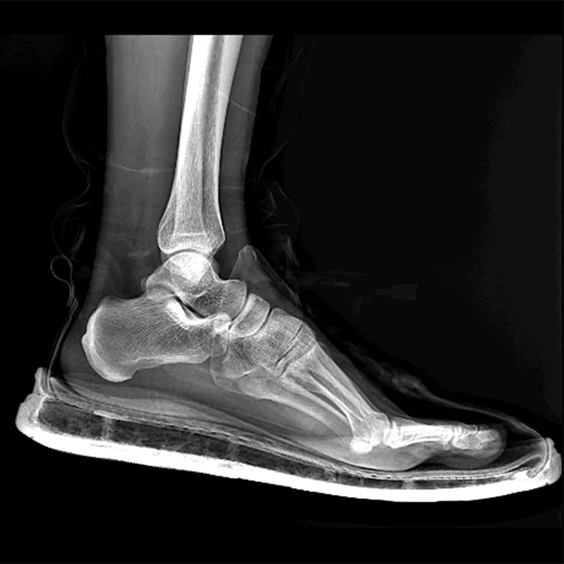 portable x-ray machine price 5KW portable digital xray 100mA mobile x ray machine