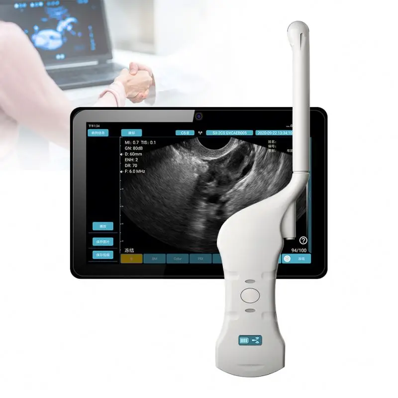 Medical Imaging Equipment Portable wireless wifi ultrasound scanner transvaginal ultrasound probe wireless