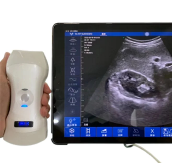 MC26 Super clear image 3 in 1 wireless ultrasound probe with 192 elements and convex, linear, cardiac function