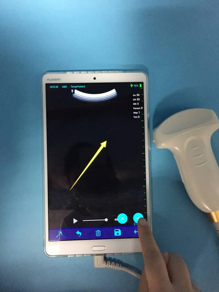 Digital ultrasound probe pocket machine ultrasound system