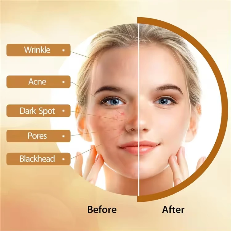 kojic acid soap