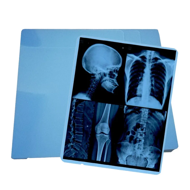 Китай, 10x12 дюймов, ПЭТ, синяя струйная медицинская рентгеновская пленка