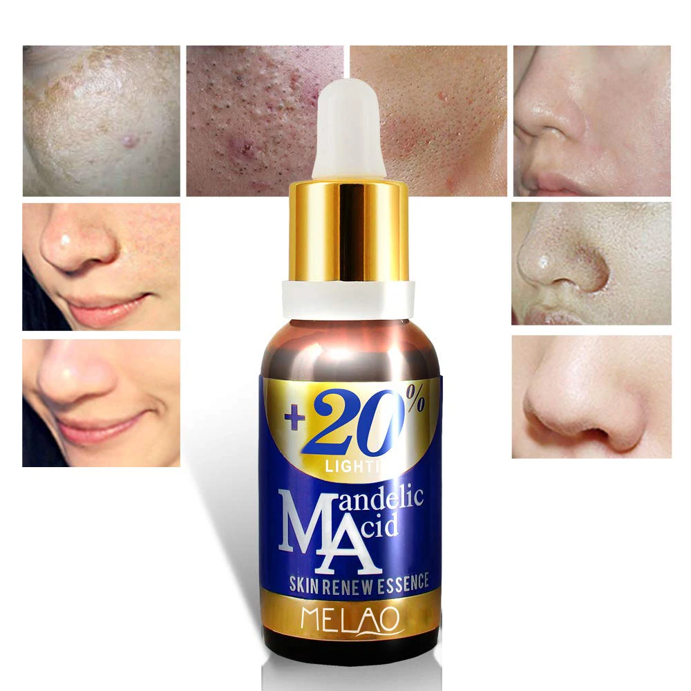 Skin care products mandelic acid serum beauty cosmetics serum anti acne Moisturizing Blemish Mandelic Acid Essential Serum