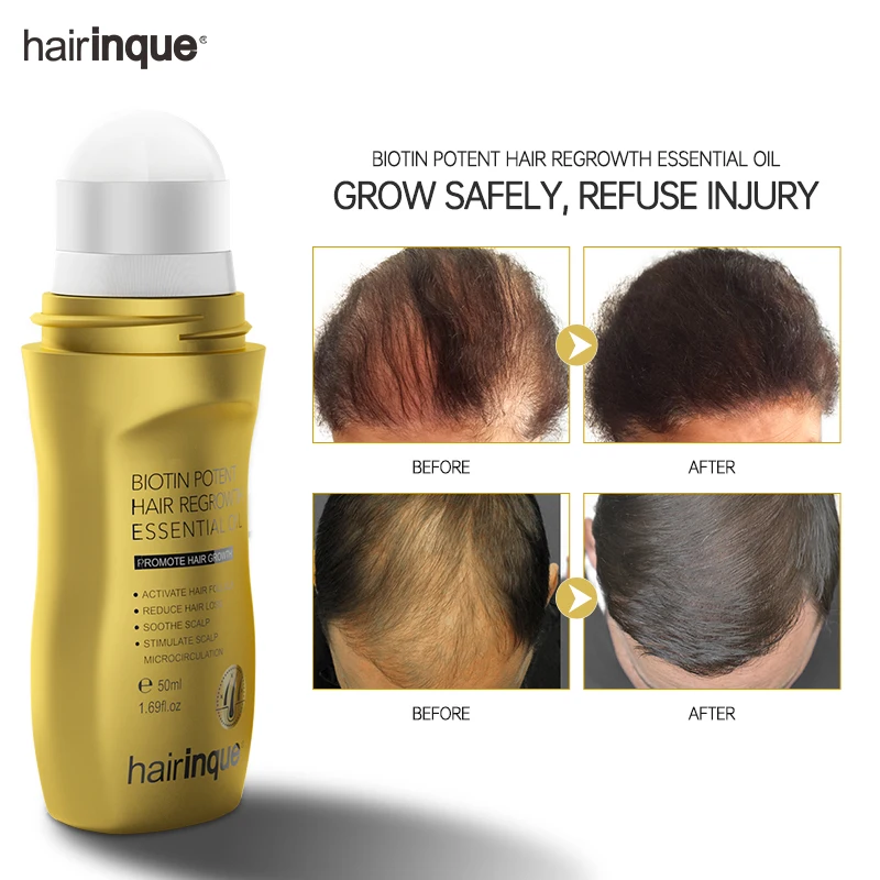 Best Quality Biotin Hair Growth Oil Natural Vitamin B7 Hair Regrowth Serum Organic Castor Oil Hair Oil Private Label