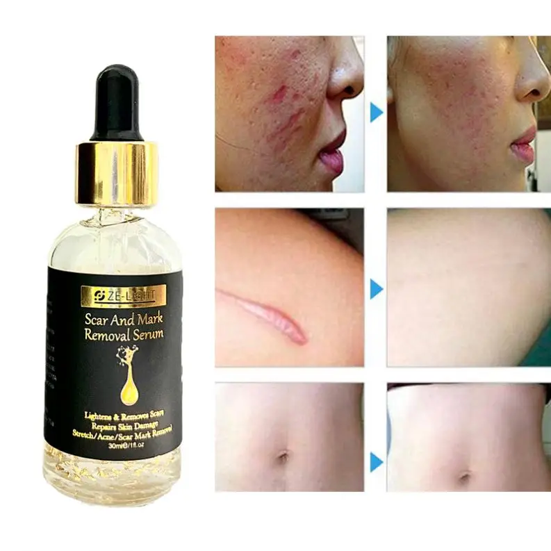 Private Label Firming Anti-Aging Retinol Skin Repair Pink Capsule Facial Serum For Spa