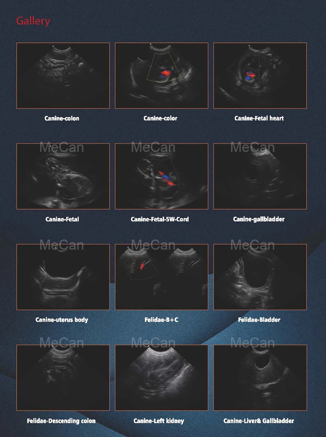 High Quality Portable Best Ultrasound Scanner Machine System 4D Ultrasound Machine With Probes For Clinic